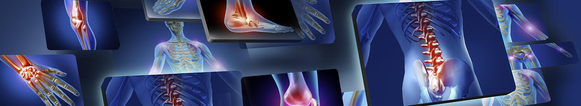 osteoporosis-6-datos-que-debes-conocer osteoporosis-6-datos-que-debes-conocer